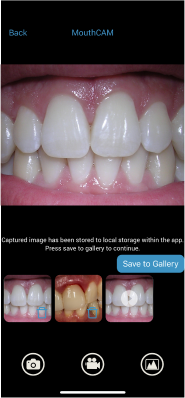 mouthcam instructions